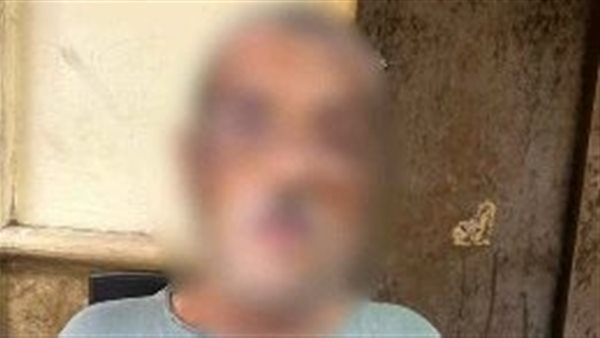 بسبب وضع بضاعة أمام ورشة.. عامل يلقي مادة ك أو ية علي 3 أشخاص بالجمالية